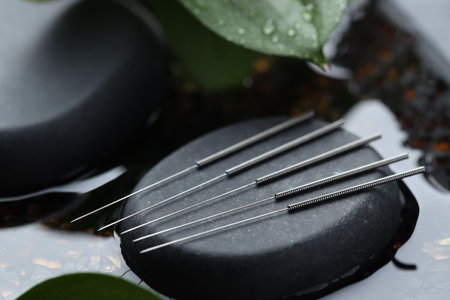 Acupuncture needles, spa stones and wet leaf in water, closeupの写真素材