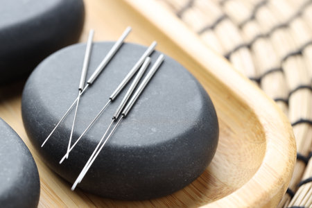 Acupuncture needles and spa stones on table, closeupの写真素材