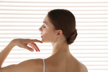 Woman with skin near blinds at home