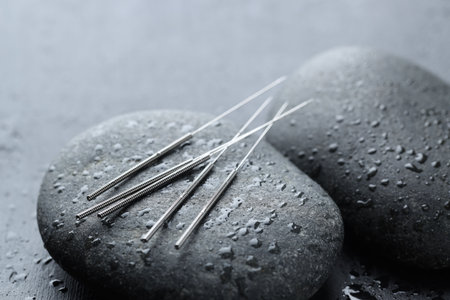 Acupuncture needles and wet spa stones on gray background, closeupの写真素材