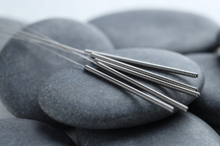 Acupuncture needles and spa stones on white background, closeupの写真素材