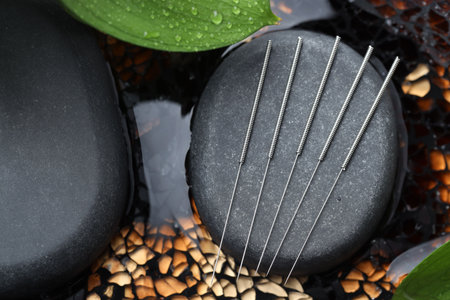 Acupuncture needles, spa stones and wet leaf in water, top viewの写真素材