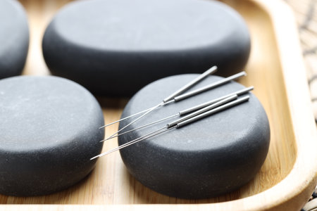 Acupuncture needles and spa stones on table, closeupの写真素材