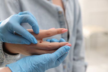 Doctor examining woman's moles in hospital, closeupの写真素材