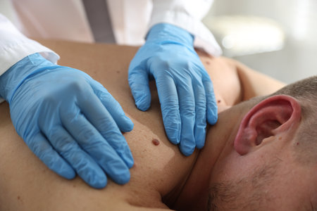 Doctor examining man's moles in hospital, closeupの写真素材