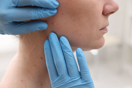 Doctor examining woman's moles in hospital, closeupの写真素材