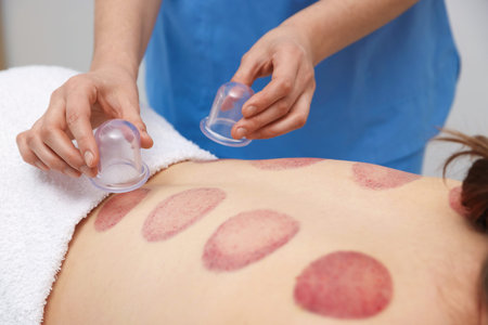 Therapist giving cupping treatment to patient in spa salon, closeup