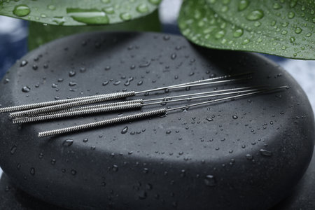 Acupuncture needles, wet spa stones and leaves on blue tray, closeupの写真素材
