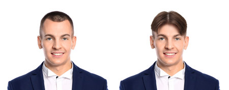 Man before and after wearing wig or hair treatment, collage