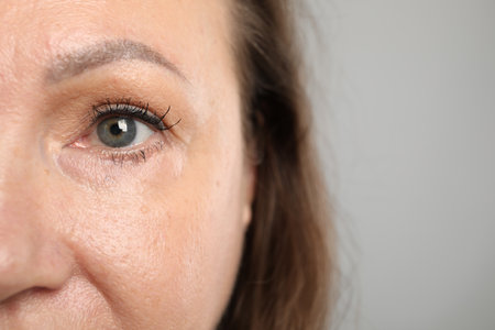 Woman before cosmetic procedure on grey background, closeup. Space for textの写真素材