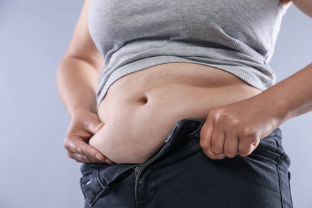 Woman with excessive belly fat on light background, closeup. Overweight problem