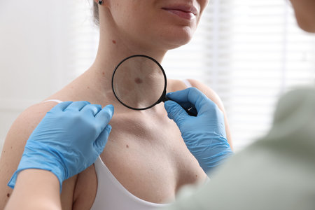 Doctor examining woman's moles in hospital, closeup