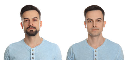 Handsome man before and after shaving on white background, collage of photos