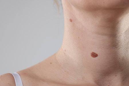 Woman with moles on her body against light background, closeup. Space for textの写真素材