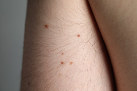 Man with moles on his body against gray background, closeupの写真素材