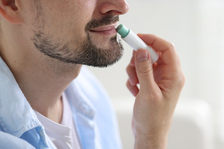 Man applying lip balm onto his lips on blurred light background, closeupの写真素材
