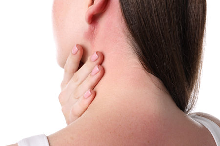 Woman with sunburned skin on white background, closeup