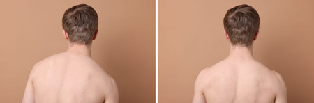 Before and after collage showing man with good and bad posture against pale brown background