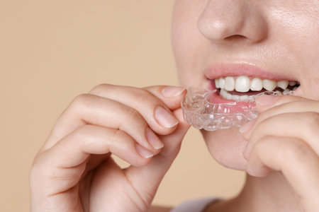 Woman wearing dental aligner on beige background, closeupの写真素材