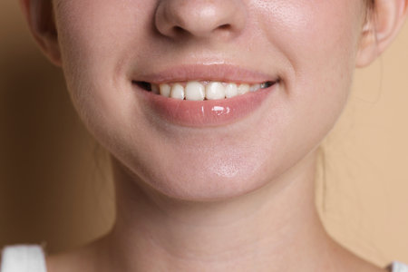 Smiling woman after dental aligners treatment on beige background, closeupの写真素材