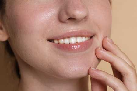 Smiling woman after dental aligners treatment on beige background, closeup