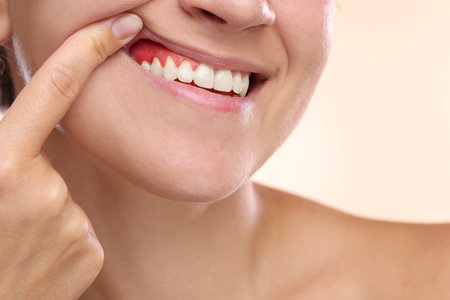 Woman showing inflamed gum on beige background, closeup