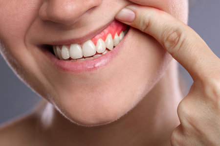 Woman showing inflamed gum on gray background, closeup