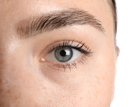 Woman before cosmetic procedure on white background, closeupの写真素材