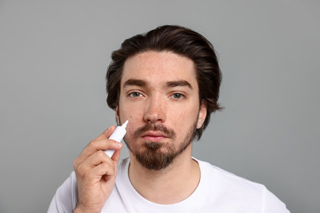 Young man with acne problem applying cream onto his face on light gray backgroundの写真素材