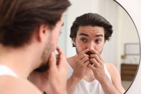 Young man with acne problem near mirror at homeの写真素材