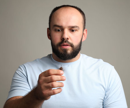 Baldness problem. Worried man with clump of lost hair on gray background