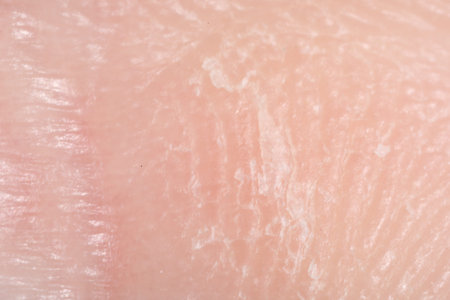 Macro view of dry human skin as background