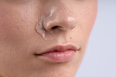 Woman with dry skin on her face against light background, closeupの写真素材