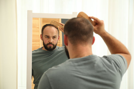 Baldness problem. Man brushing his hair with comb near mirror at homeの写真素材