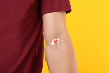 Blood donation. Man with bandage on arm against yellow background, closeup