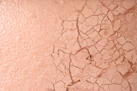Dry skin presented as double exposure with cracked soilの写真素材