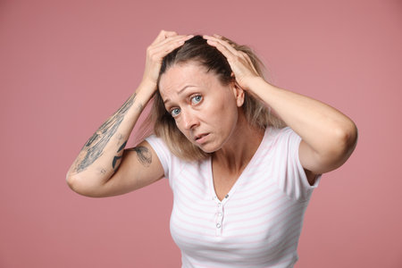 Worried woman with hair loss problem on pink backgroundの写真素材