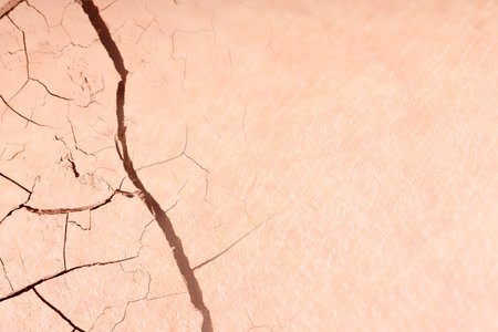 Dry skin presented as double exposure with cracked soilの写真素材