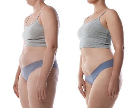 Before and after collage showing woman with good and bad posture against white background, closeupの写真素材