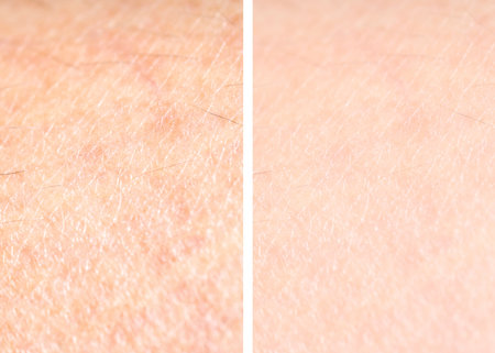 Dry skin before and after moisturizing, macro view. Collage for comparisonの写真素材