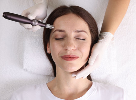 Woman undergoing microneedling procedure in beauty salon, top view