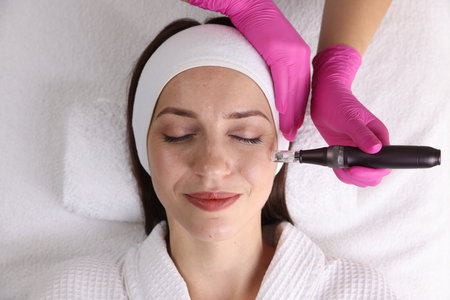 Woman undergoing microneedling procedure in beauty salon, top view