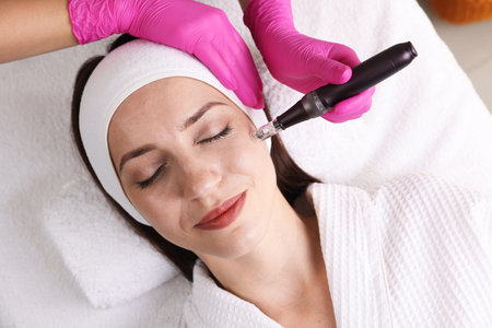 Woman undergoing microneedling procedure in beauty salon, top viewの写真素材
