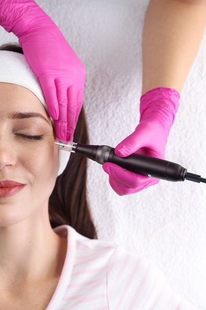 Woman undergoing microneedling procedure in beauty salon, top view