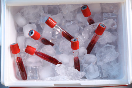 Portable medical refrigerator with blood samples, top view