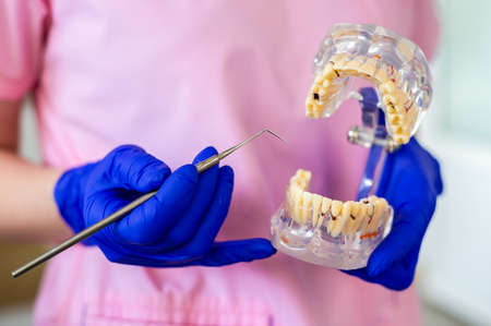 Dentist doctor woman in a mask and gloves holds an artificial jaw. Checking and dental treatment in a dental clinic. Oral hygiene and treatment.の写真素材