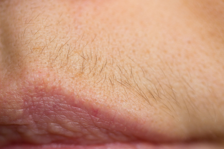 small hairs above the lips. women problemsの写真素材