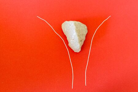 Stone stuck in narrow place. concept imageの写真素材