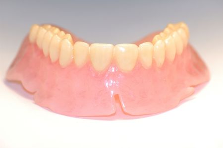 An upper denture