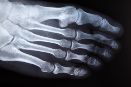 close up of human leg bone X-rays, Medical examination of the current commonly used imaging test, Medical Institutions in Luannan County, Hebei Province of China.
の写真素材